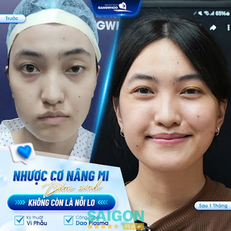 Bệnh viện thẩm mỹ Gangwhoo: 576 Cộng Hòa, P. Tân Bình