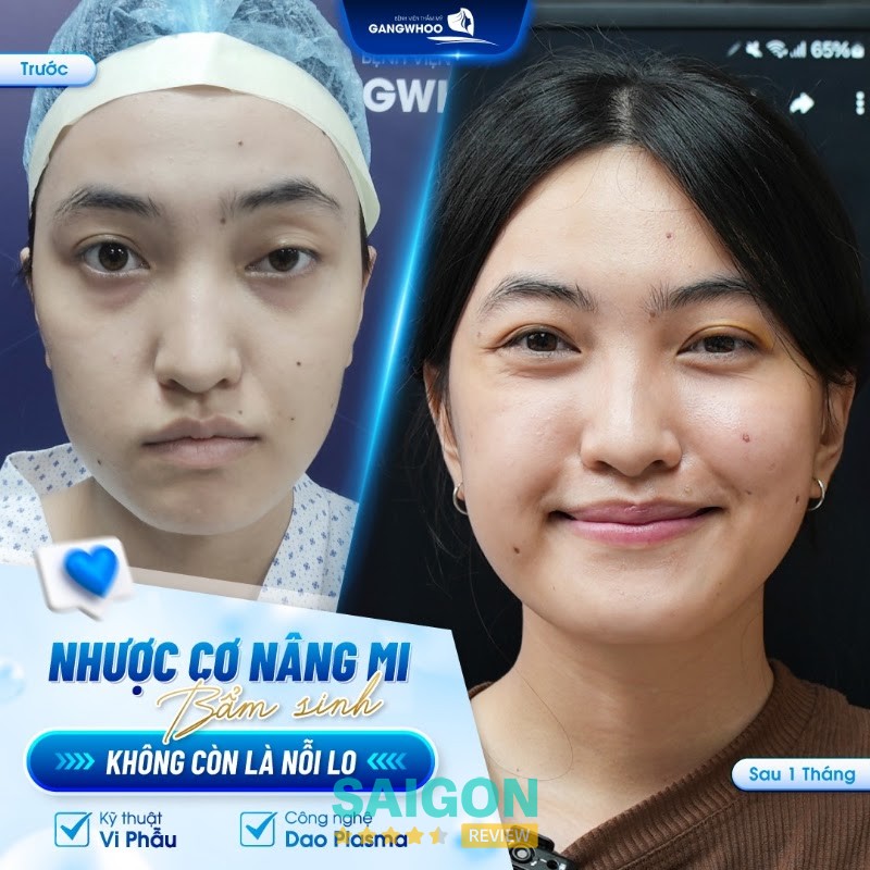 Bệnh viện thẩm mỹ Gangwhoo – hình ảnh 1