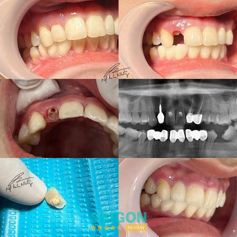 Nha khoa Dentori hình ảnh 3