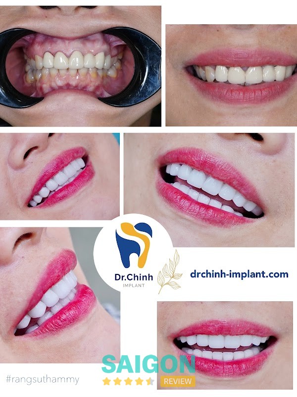 Dịch vụ Nha Khoa Dr.Chinh Cát Lái