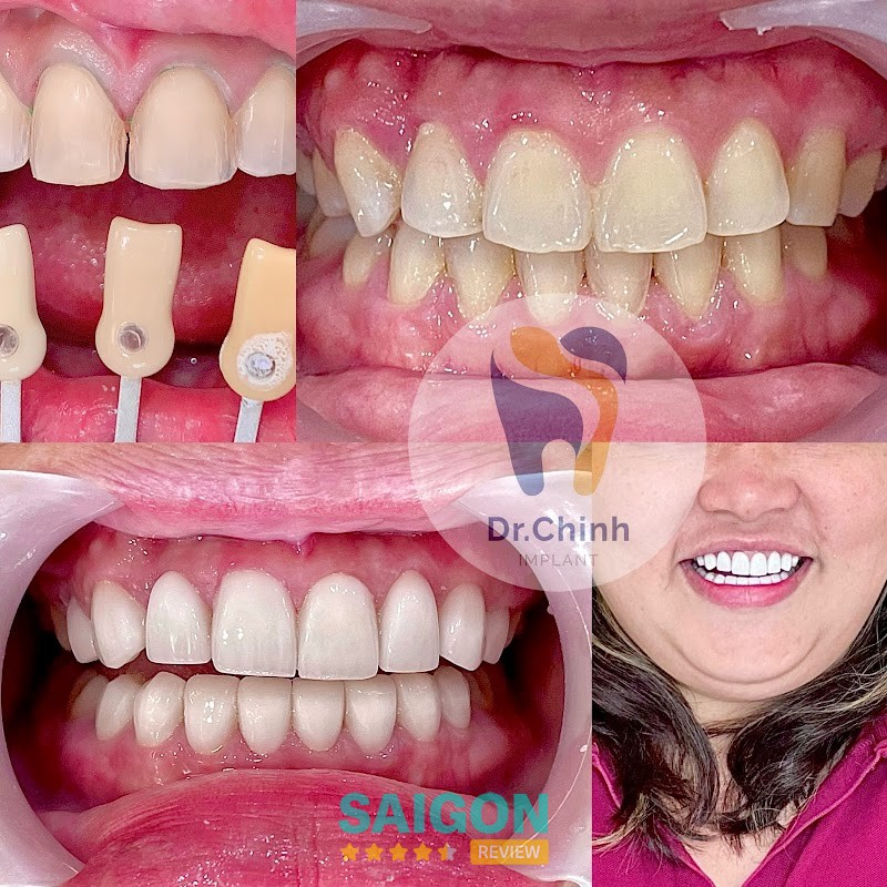 Dịch vụ Nha Khoa Dr.Chinh hình ảnh 3