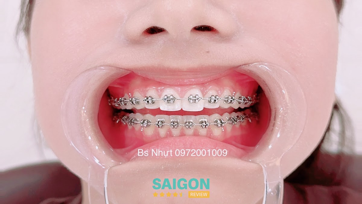 Nha Khoa Minh Nhựt Chợ Quán