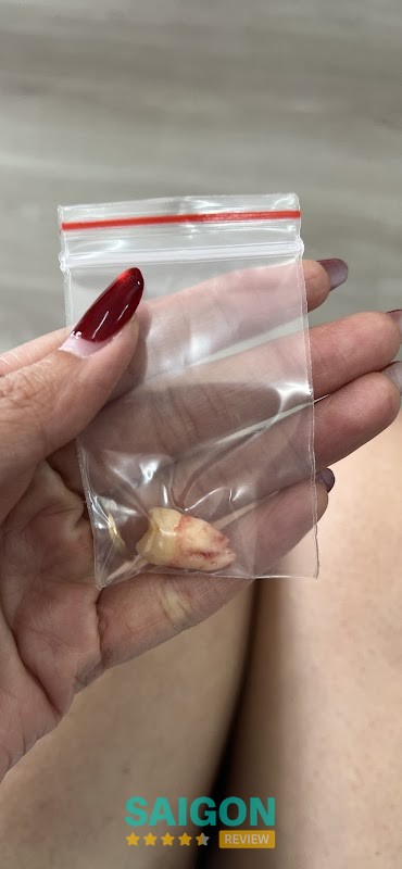 Nha Khoa Kỹ Thuật Số – hình ảnh 2