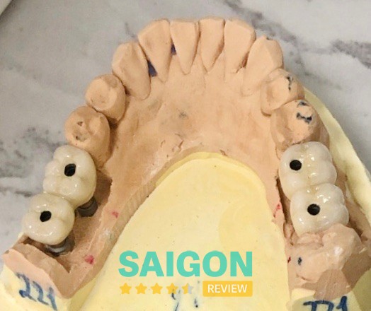 Nha Khoa Diễm Quỳnh – 231 Nguyễn Tiểu La, Diên Hồng, Hồ Chí Minh, Việt Nam